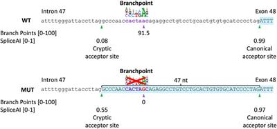 ABCA4 c.6480-35A>G, a novel branchpoint variant associated with Stargardt disease